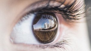 Iris-Heterochromie: Was bedeutet das?