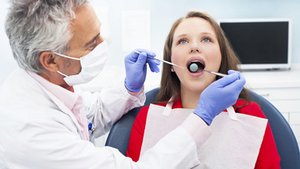 Bleaching: wie gelbverf&auml;rbte Z&auml;hne weiss werden