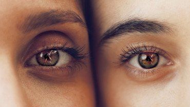 Ein Auge ist blau, ein Auge ist braun