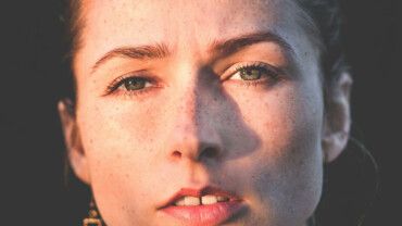 Pigmentflecken: Sonnenschutz auch im Winter