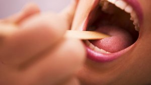 Was die Zunge &uuml;ber unsere Gesundheit verr&auml;t