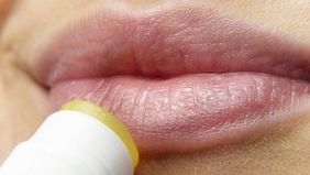 Das hilft gegen spr&ouml;de Lippen