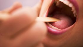 Die Zunge als Spiegelbild der Gesundheit