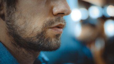 Minoxidil bei Haarausfall