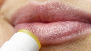 Das hilft gegen spr&ouml;de Lippen
