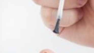 Warzen: h&auml;sslich aber ungef&auml;hrlich!