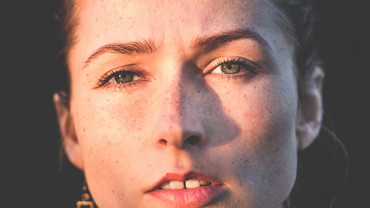 Pigmentflecken vorbeugen?