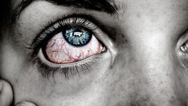 Fremdk&ouml;rper richtig aus dem Auge entfernen